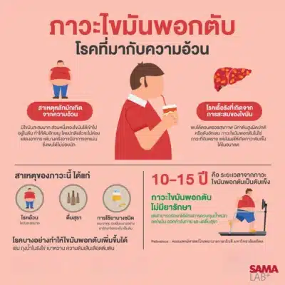 ภาวะไขมันพอกตับ โรคที่มากับความอ้วน